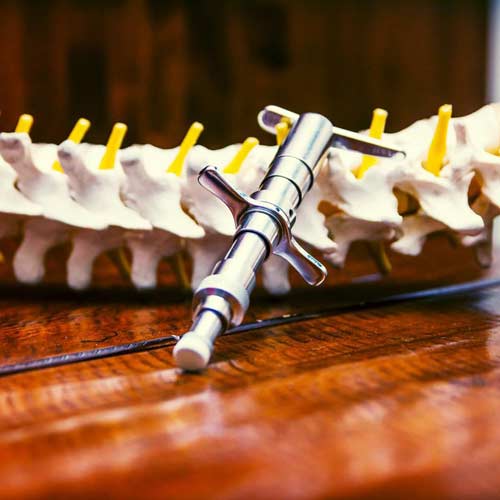 integrator chiropractic tool